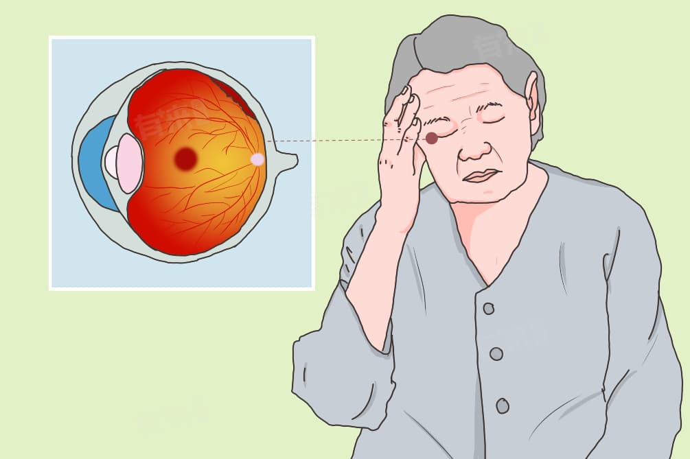 视网膜黄斑病变怎么治