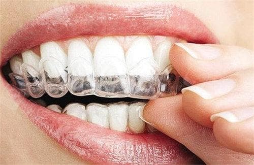 淘宝4D隐形牙套能矫正牙齿吗？不靠谱！正畸是口腔医疗行为~需要专科医生操作！
