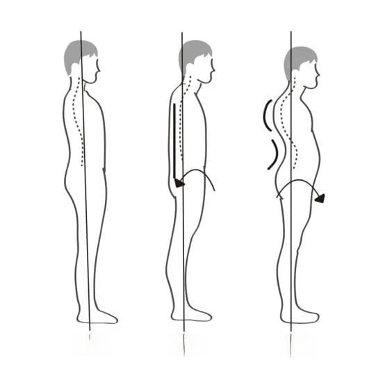 别再刻意抬头挺胸！医生教你正确脊椎保健法