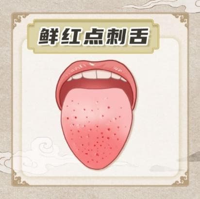 舌象揭秘：点刺、裂纹、舌头短缩、舌苔变化，你的舌头在说什么？