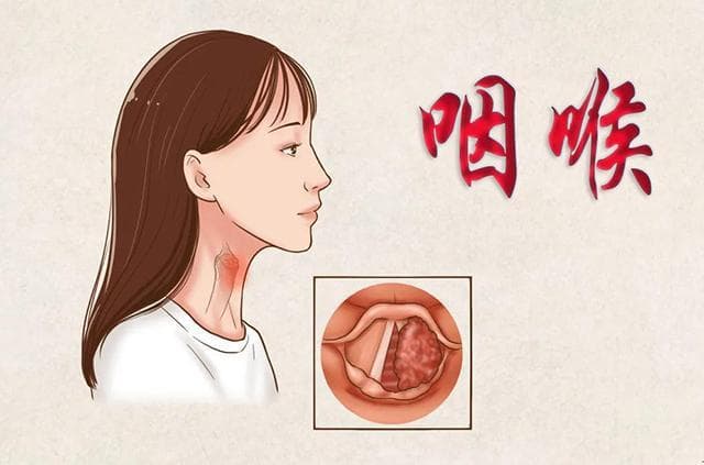 喉咙不舒服怎么办？六个实用建议帮你缓解不适