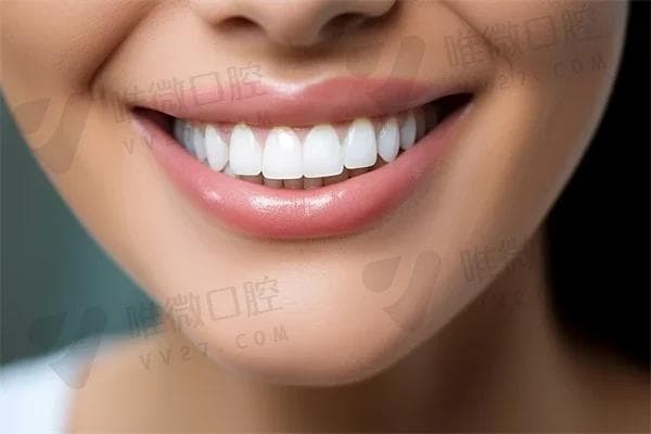 如果口腔内存在牙结石，是否应该进行洗牙以改善口腔健康？