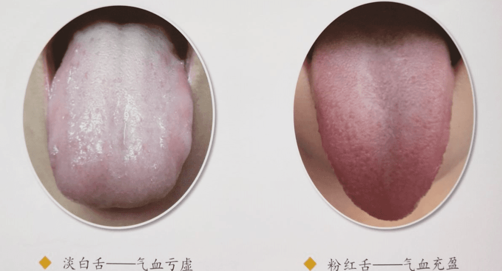 高清小儿舌诊图谱，堪比教科书（建议收藏！）