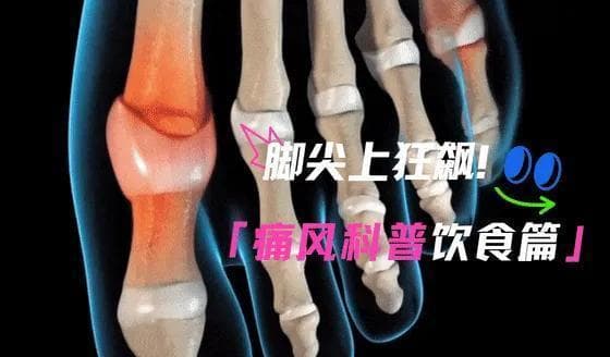 脚尖上狂飙——痛风科普之饮食篇