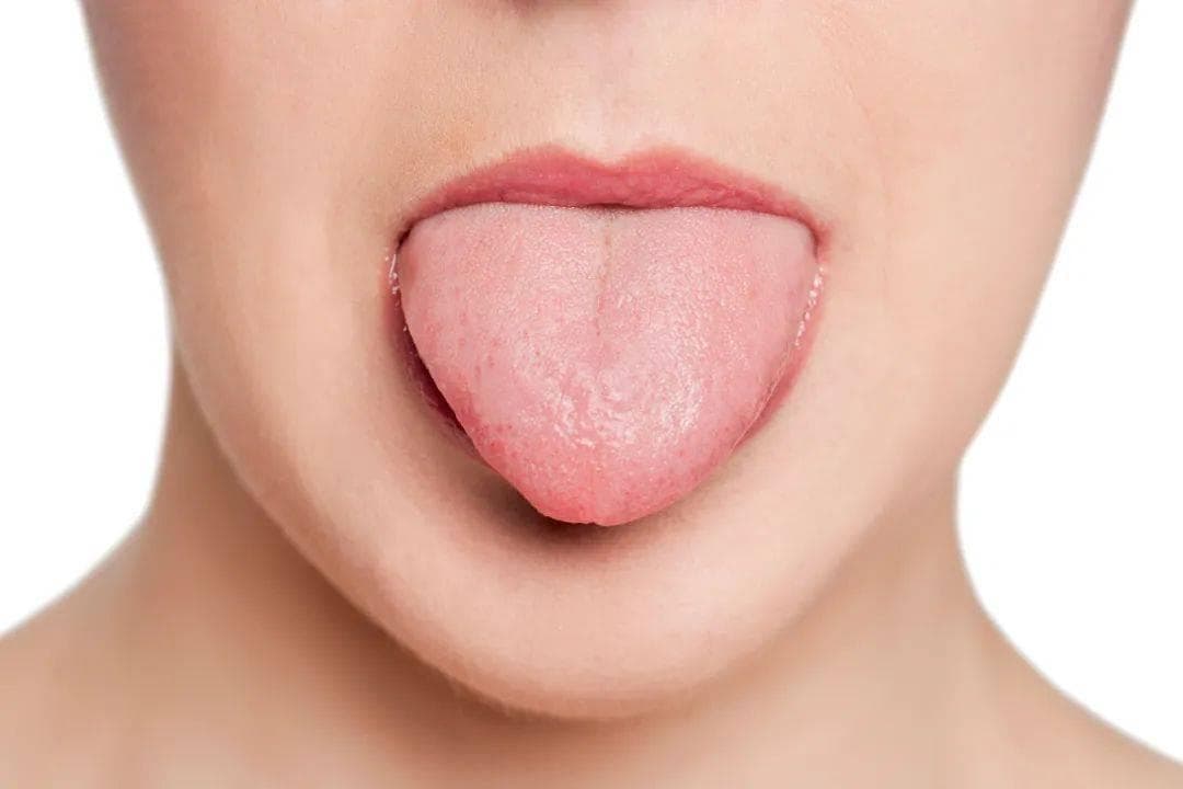 10种「舌质」可能是病了