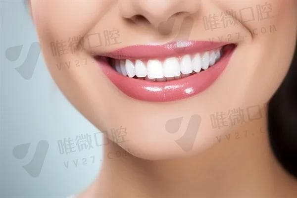 第一次洗牙后牙齿真的会变白吗？洗牙的效果与注意事项全解析