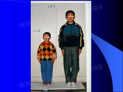 小孩身高不达标去医院挂什么科