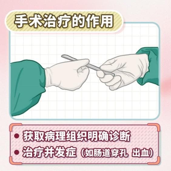 淋巴瘤治疗百科：从化疗到骨髓移植的全面解读