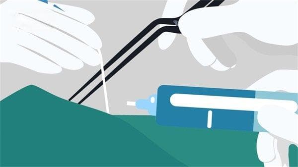儿童脑动静脉畸形：病因、症状、检查、治疗及护理全解析