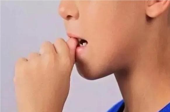 啃手指咬嘴唇，当心孩子长“残”了