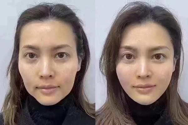 夫妻宫面相分析：如何从面部特征看婚姻运势