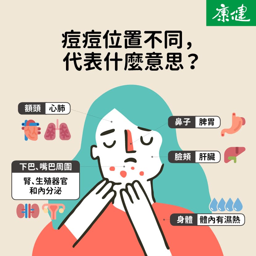 痘痘一直好不了？痘痘位置代表什么？皮肤科医师详解治痘方法