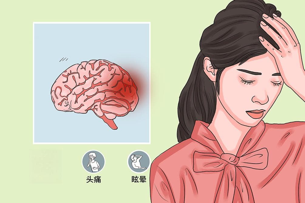 脑供血不足是什么原因引起的