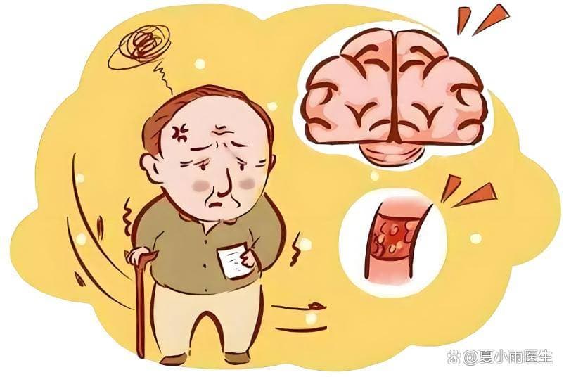 迷走神经电刺激(VNS)：脑卒中后上肢功能障碍康复的“黑科技”？