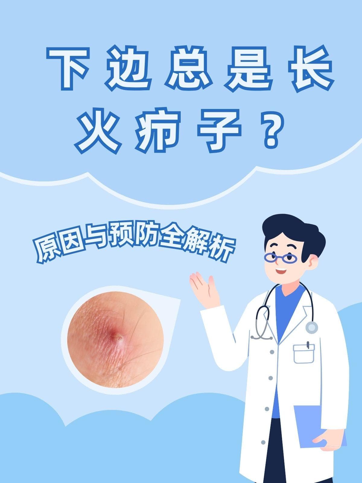 火疖子：从清洁到就医，医生详解预防与治疗