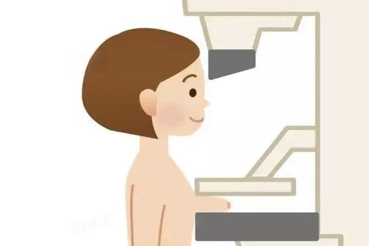 钼靶到底有没有必要做