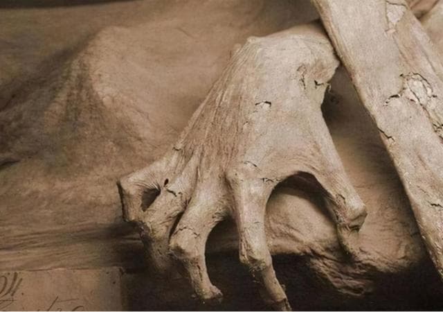 新疆出土9000年前木乃伊，展现古人医疗智慧