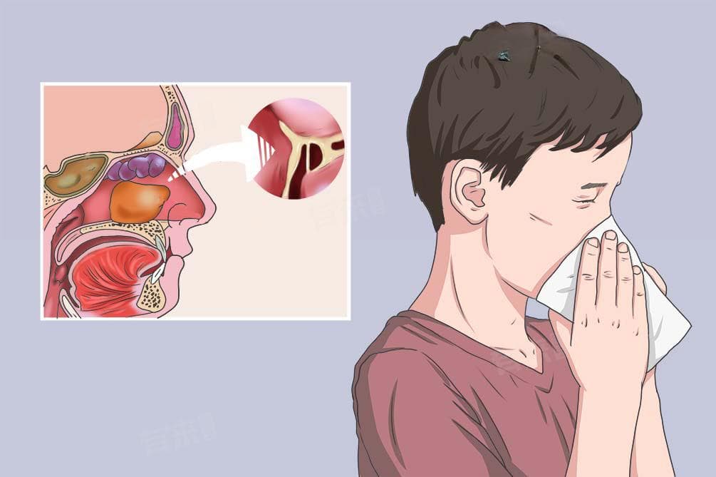 鼻窦炎是什么原因