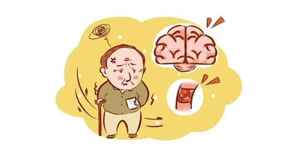 科普 | 得了脑卒中，你失眠了吗？