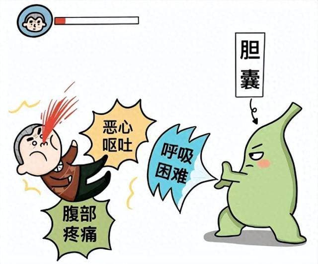 胆结石患者日常饮食指南：六大问题解答与实用建议