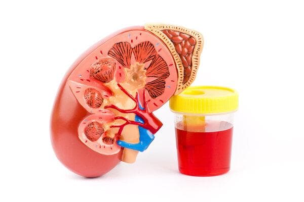 腹痛血尿的检查方法