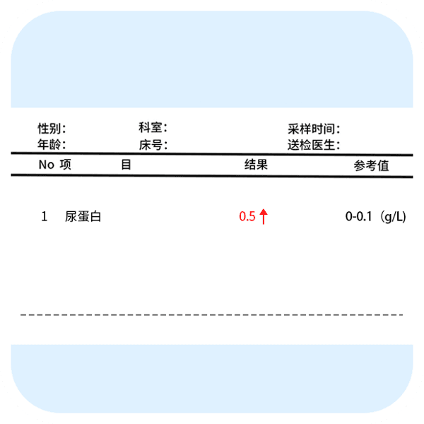 总胆汁酸高怎么回事