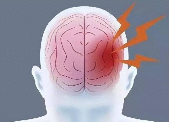 腔梗到底是个什么病，危险不？出现这5个症状，及时就医！