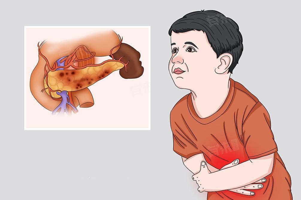 慢性胰腺炎要治疗多久