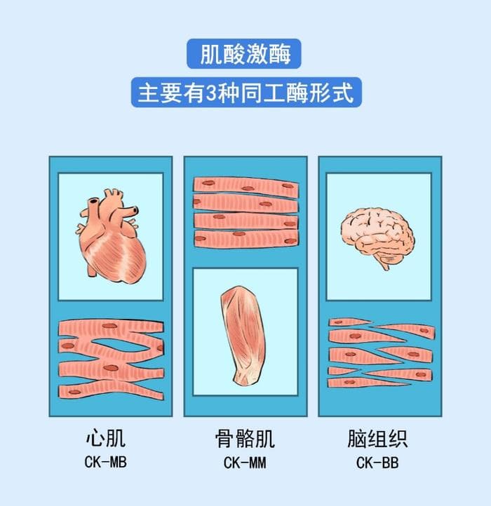 肌酸激酶升高背后：运动、药物等多因素影响需理性看待