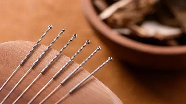 中医针灸的针具奥秘：为什么仍有近代医家还在使用银针？