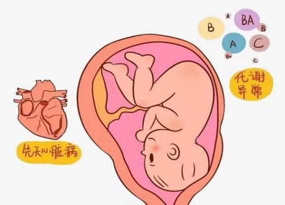 先天性心脏病介入治疗