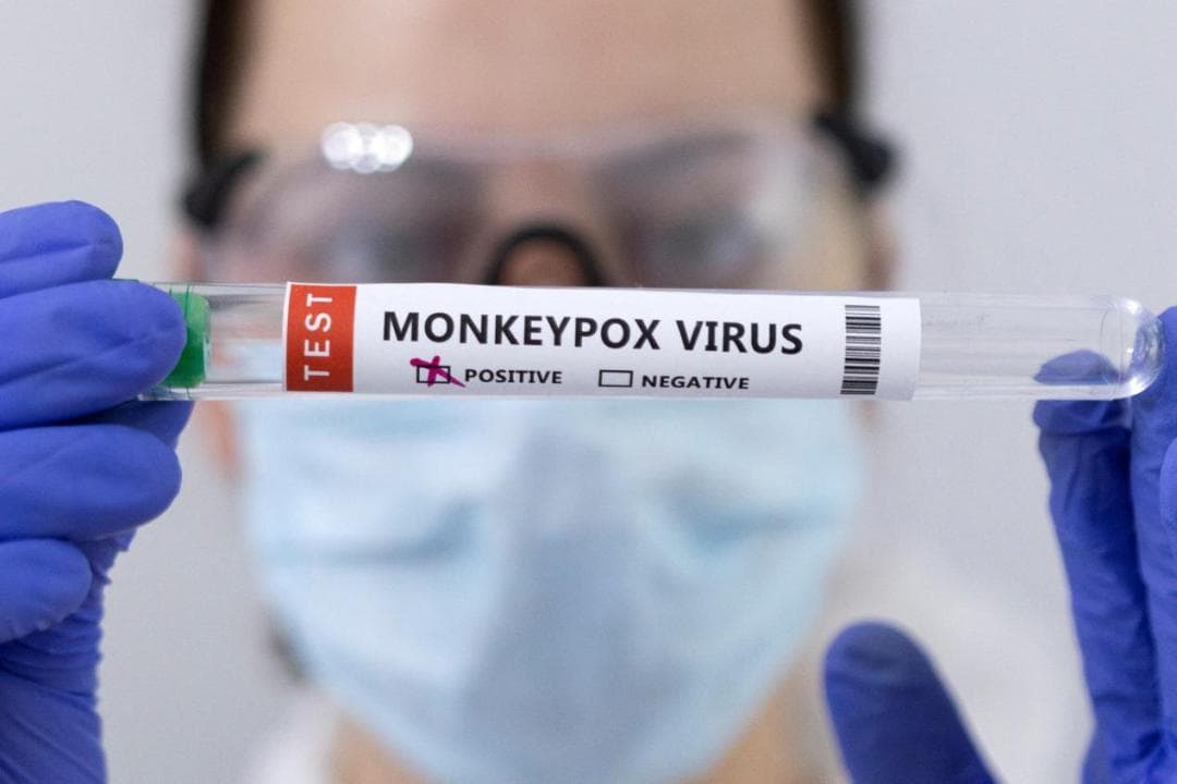 警惕！全球多国猴痘疫情持续蔓延