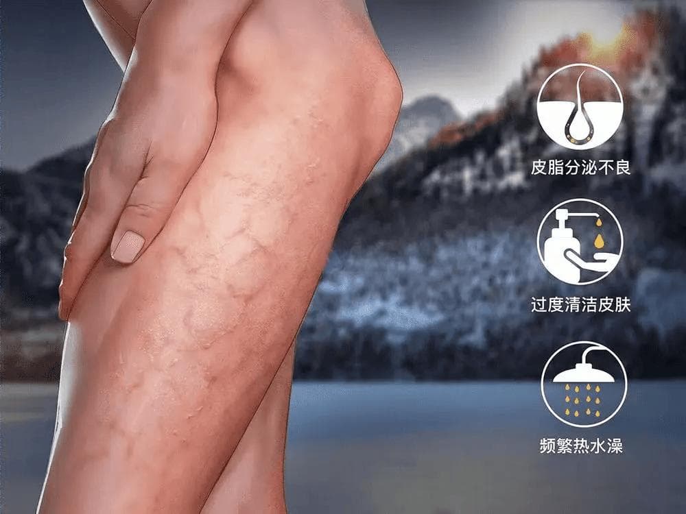 听劝，冬天真的不能天天洗澡！