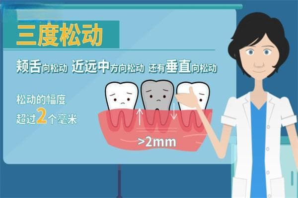牙齿松动分级与处理方法全解析