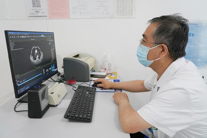 中药汤剂助力，胆结石术后复发率降两成