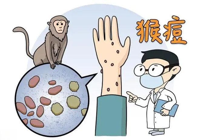 关于猴痘你需要了解的14个问题