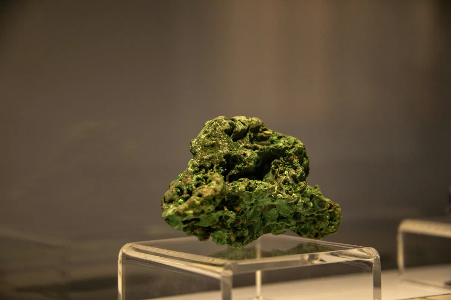 胆囊炎和胆结石患者的心理调节指南