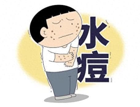 冬季水痘高发期，出现症状及时就医，做好隔离，日常护理记住3点