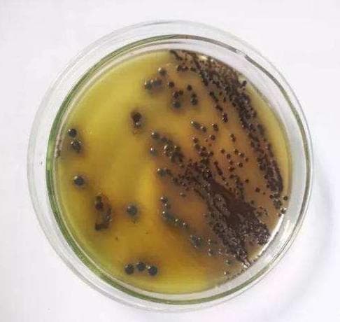 常见微生物在常见选择性培养基上的菌落特征