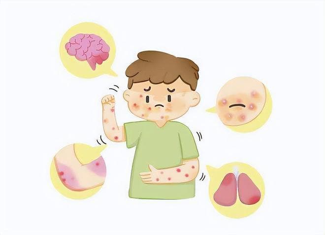 皮肤出现瘙痒、红斑、油腻，是脂溢性皮炎惹的祸，治疗记住3点