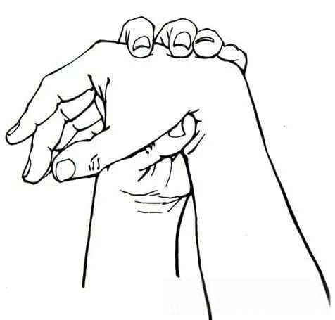 腕管综合征（carpal tunnel syndrome，CTS）诊疗