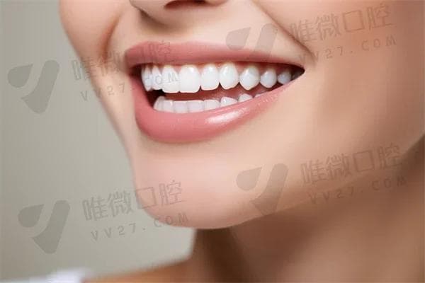 根管治疗的费用究竟哪一次昂贵？深入解析四次治疗的价格差异