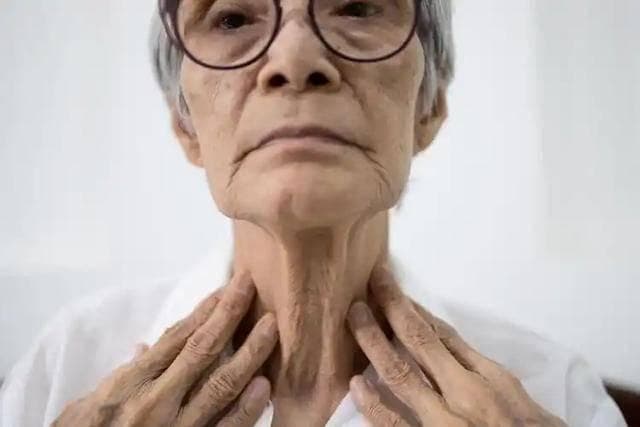 甲状腺癌不会无缘无故复发？医生：会复发的患者，多是4事没做好