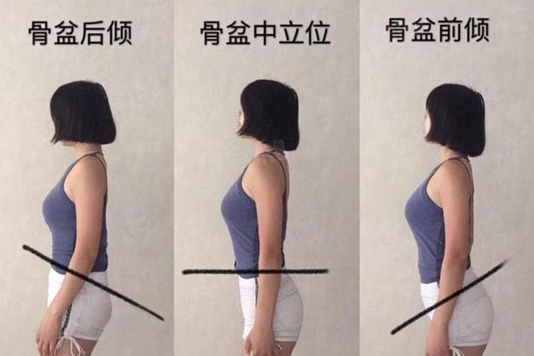 骨盆前倾睡姿：四种推荐睡姿及全方位管理指南