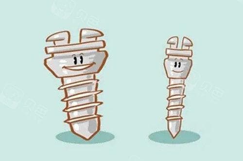 牙齿矫正一定要打骨钉吗？骨钉适应症及副作用全解析