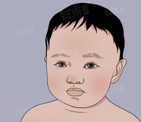 新生儿脸发红是怎么回事