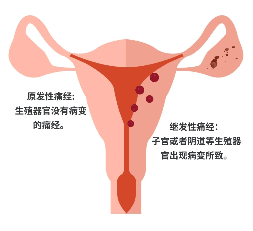 女朋友那几天到底有多痛？可别再说“多喝热水”了