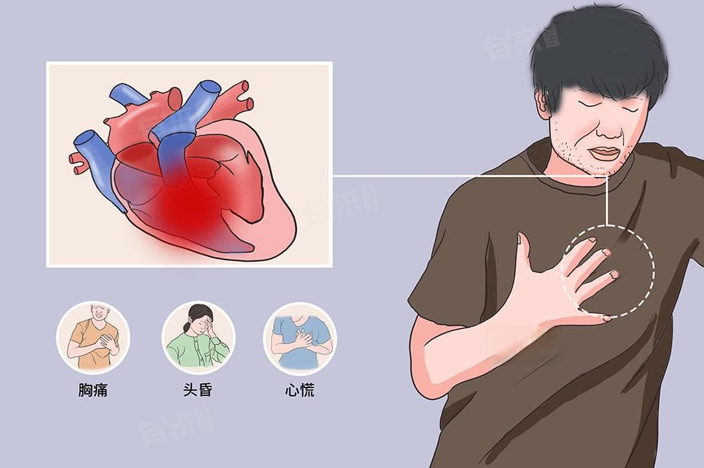 心脏病早期症状和预防方法
