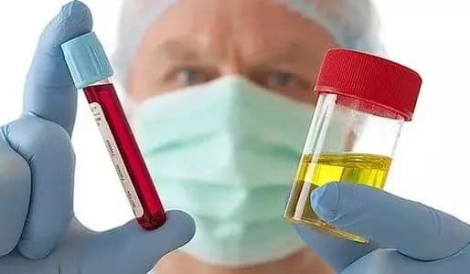 医生是如何诊断血尿的？