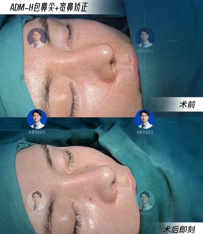 4种常见的脚气类型及正确用药指南